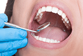 sensitive teeth Newport News dentist